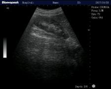 Clinical Images - Convex probe