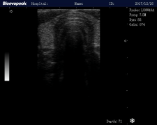 Clinical-Images-Linear-probe