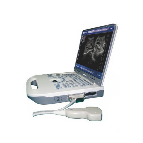 Ultrasound-Machine,-Black-&-White,-US-HS50A