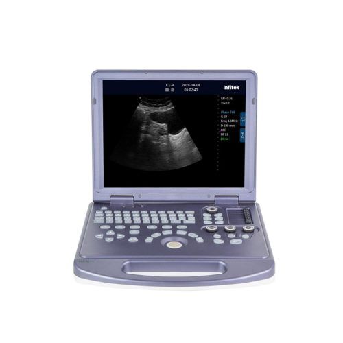 Ultrasound-Machine-us-h360