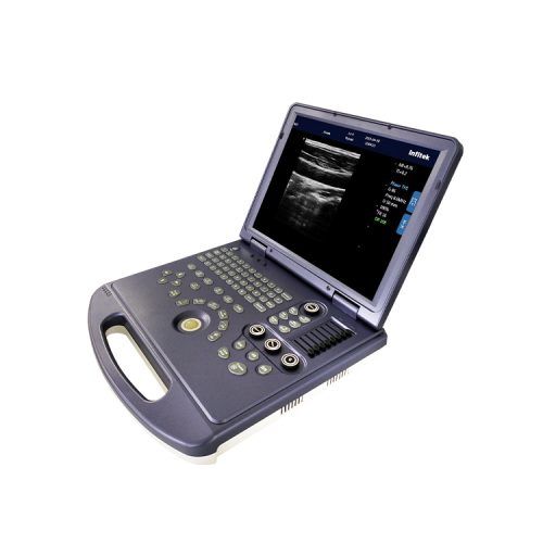 Ultrasound-Machine-us-h360