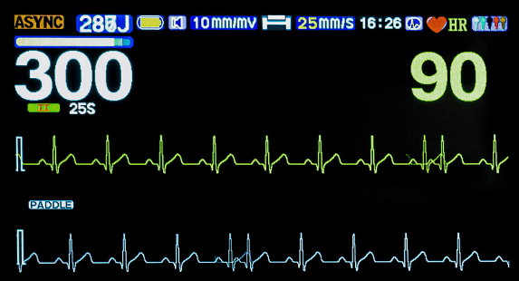 Defibrillator, DB-8000BD display