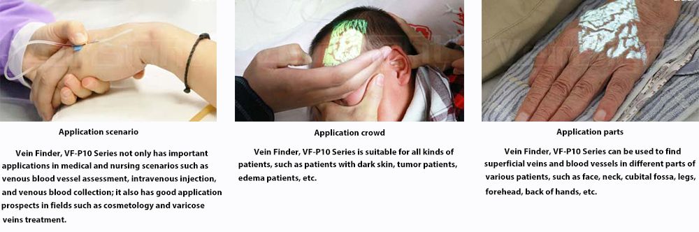 vein finder
